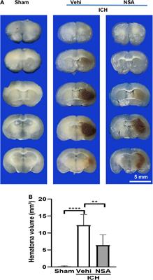 Necrosulfonamide Alleviates Acute Brain Injury of Intracerebral Hemorrhage via Inhibiting Inflammation and Necroptosis